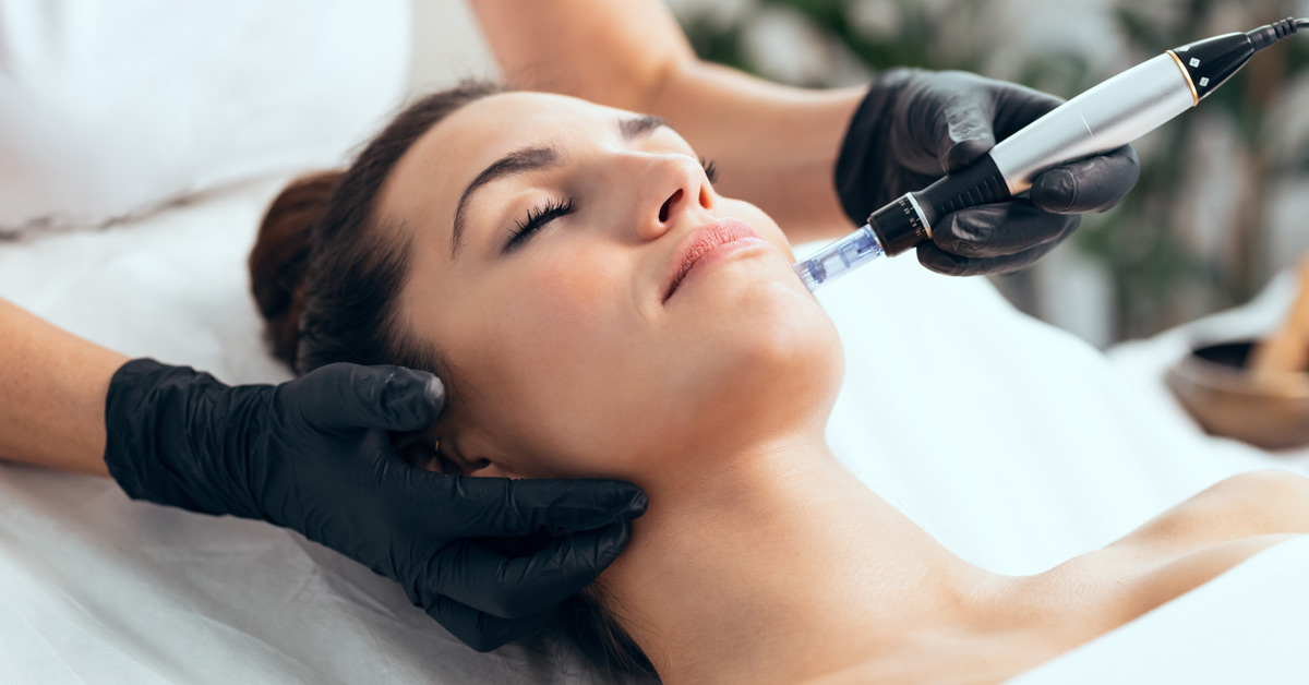 Microneedling Radiofrequency (MNRF) Treatment