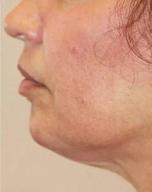 After - Before and After Case 1