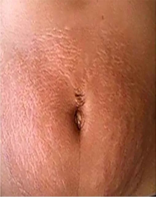 Before and After Case 2