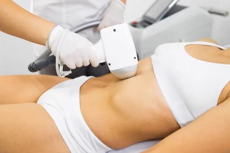 3. Advanced Liposuction Techniques image 5