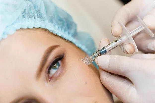 1. Cheek Fillers (Mid-Face Volume Restoration)