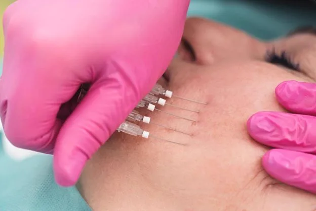 6. Collagen Boost Threads (Skin Tightening Threads) image 1