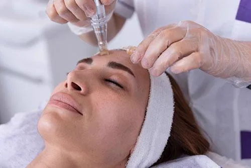 5. Combination Treatments (Exosomes + Microneedling / MNRF) image 1