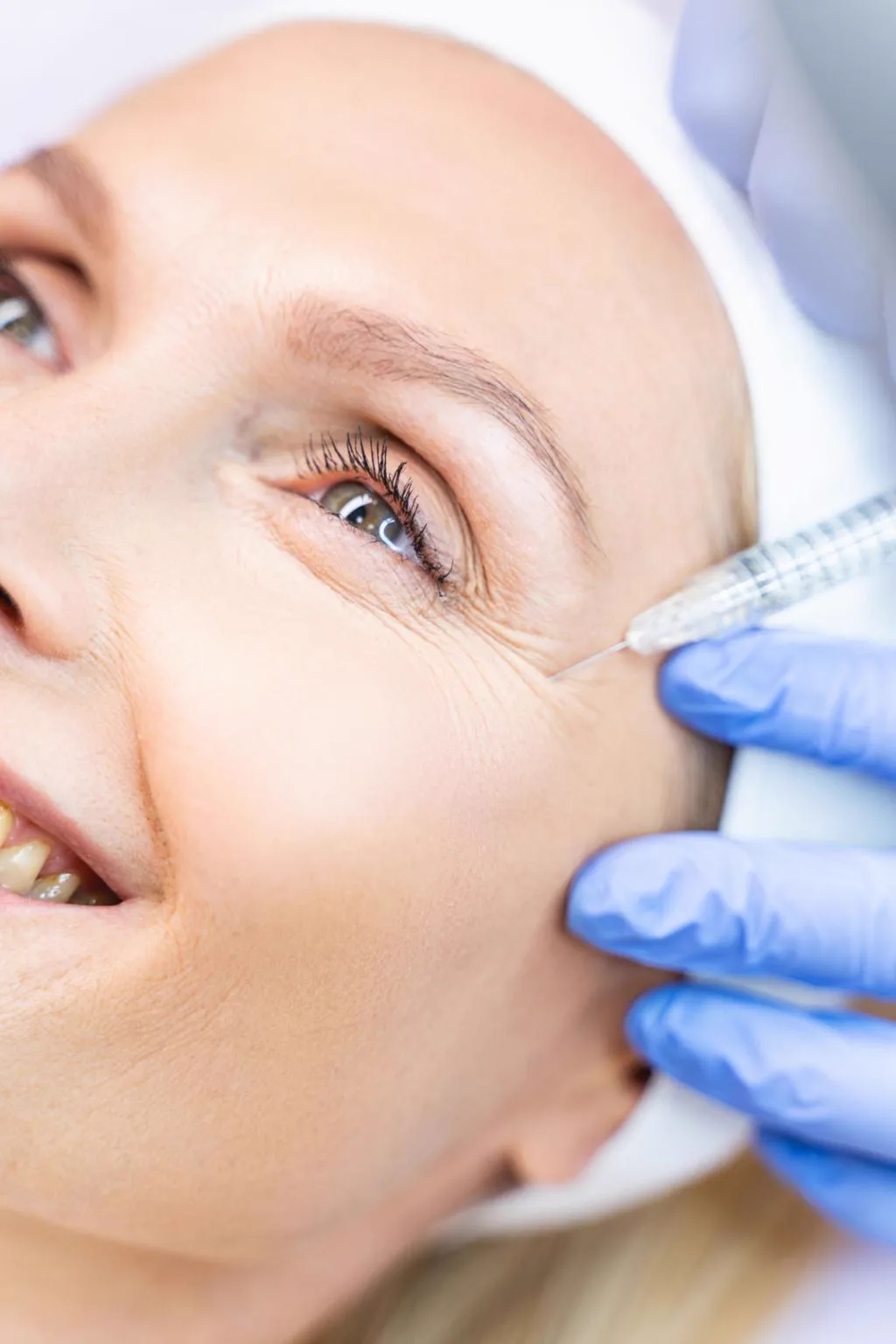5. Combination Treatments (Profhilo + Botox / Fillers / MNRF) image 3