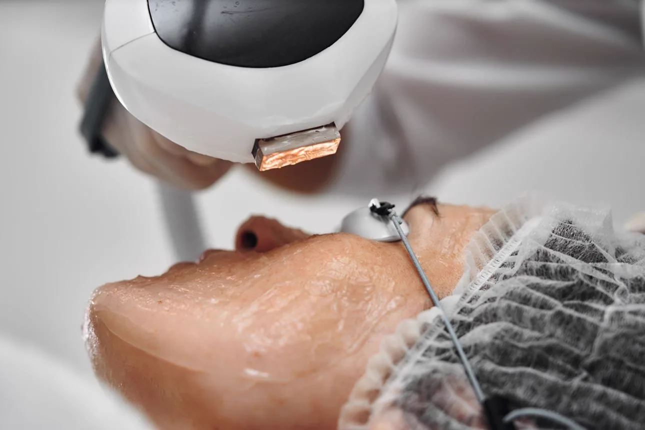6. Combination Treatments (Skin Boosters + Microneedling / Laser) image 2