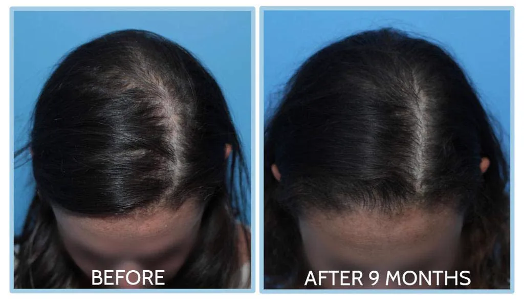 6. Customized Hair Treatment Plans image 2
