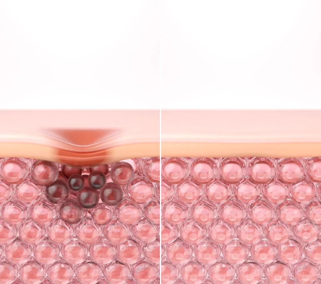 3. Exosomes for Pigmentation & Uneven Skin Tone image 2