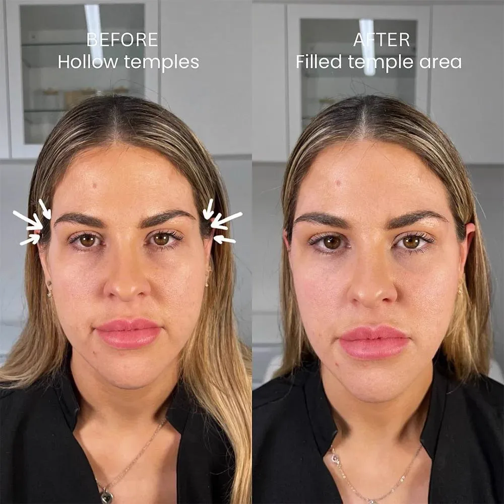 4. Facial Contour Smoothing & Feminization image 3