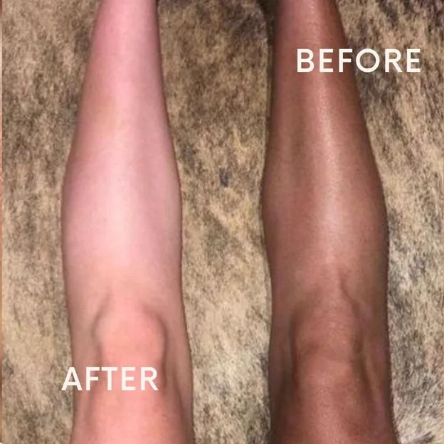 2. Full Body De-Tanning Treatment