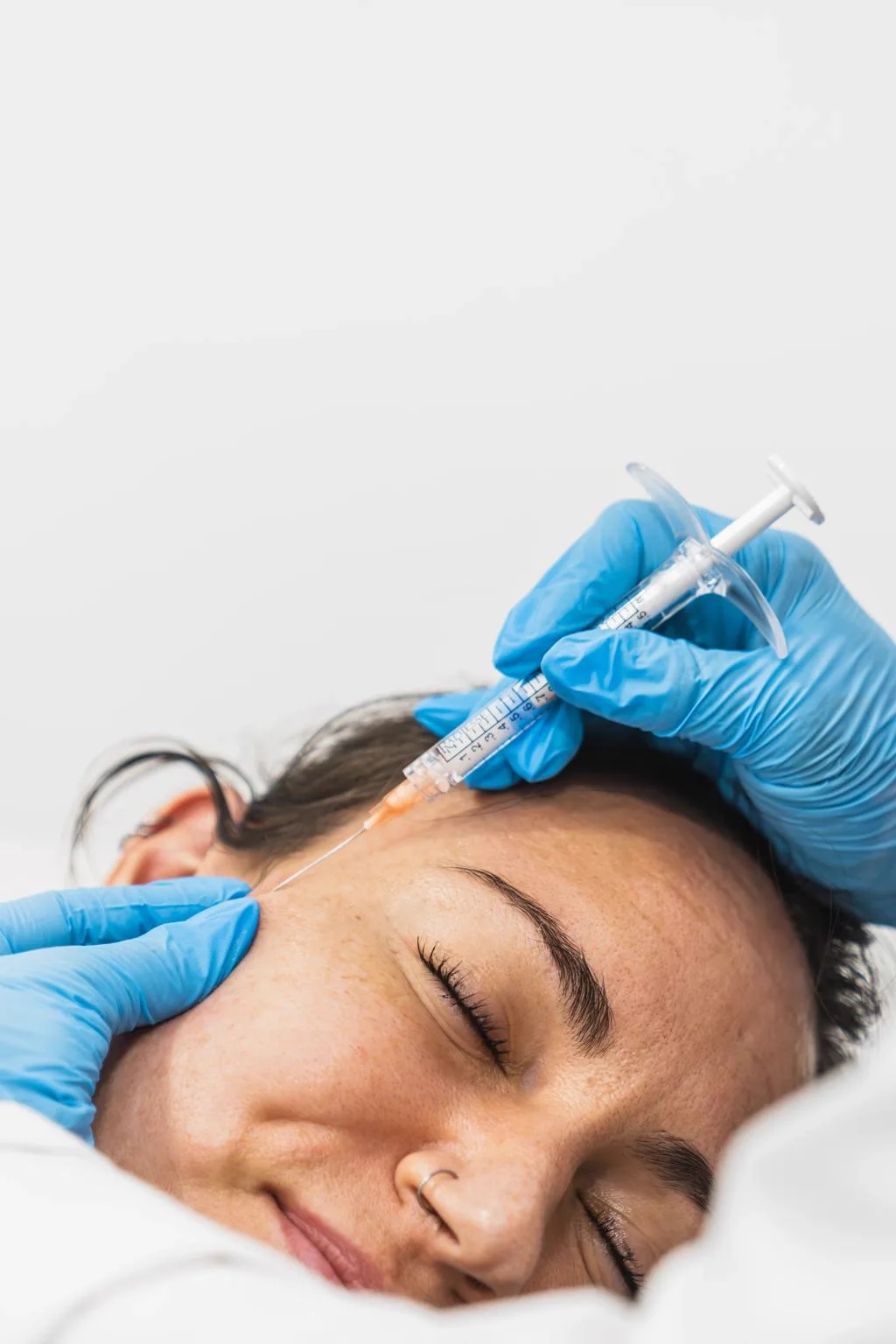 1. Full Face Rejuvenation with Sculptra