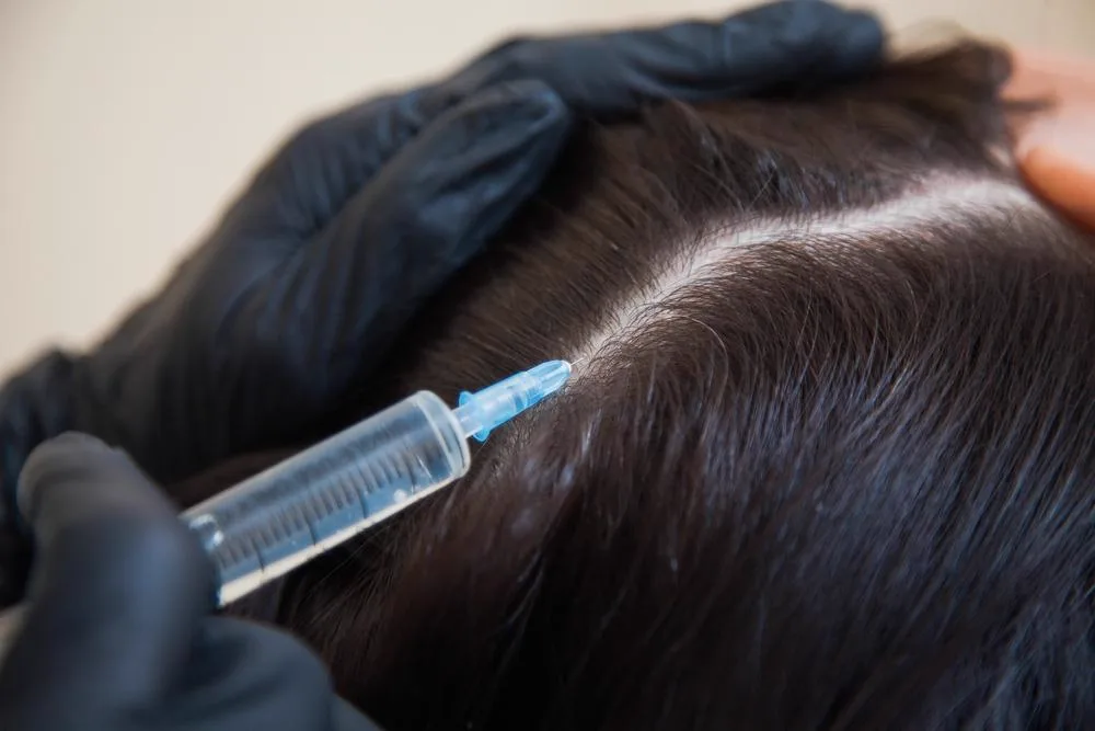 2. GFC / Grofactor Therapy for Hair Regrowth image 2