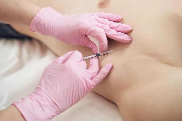 7. Hyperhidrosis Treatment (Excess Sweating) image 3