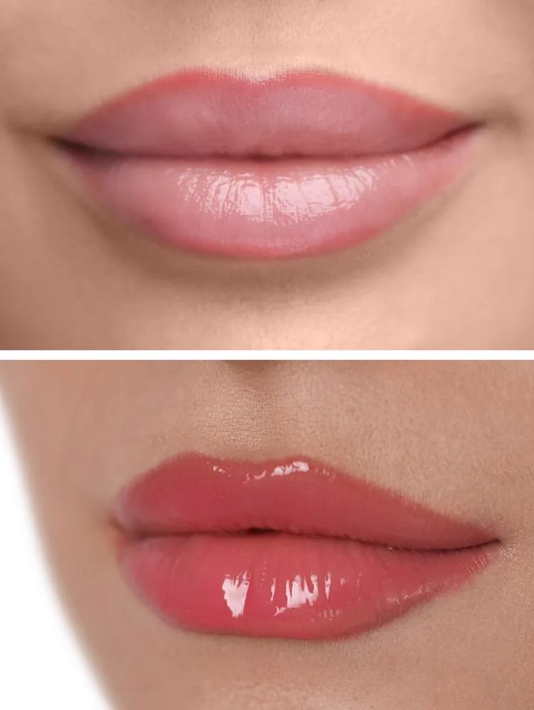 1. Lip Micropigmentation (Lip Blush) in Guwahati image 3