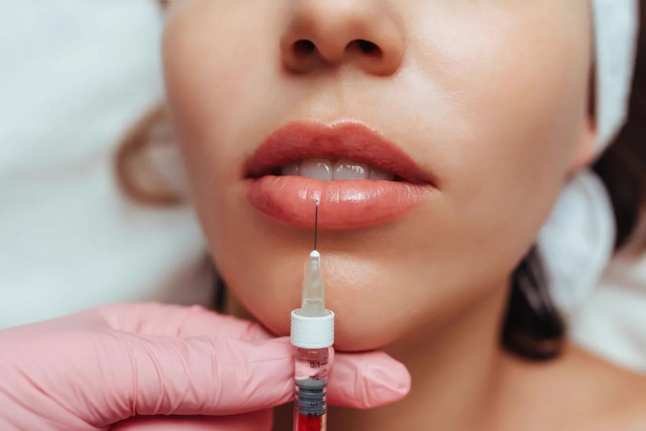 2. Lip Shape & Contour Correction image 1