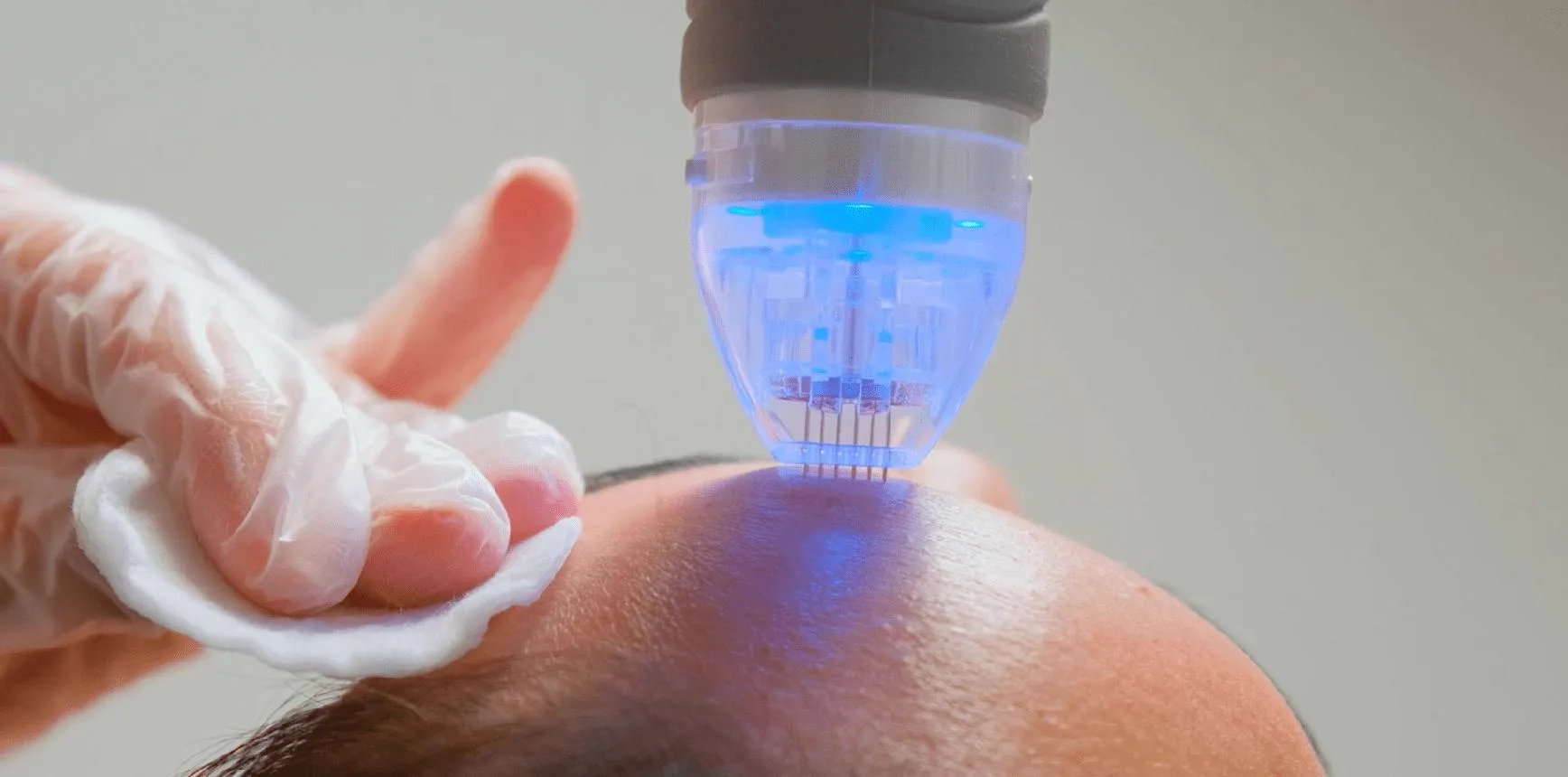 3. MNRF for Open Pores & Skin Texture image 2