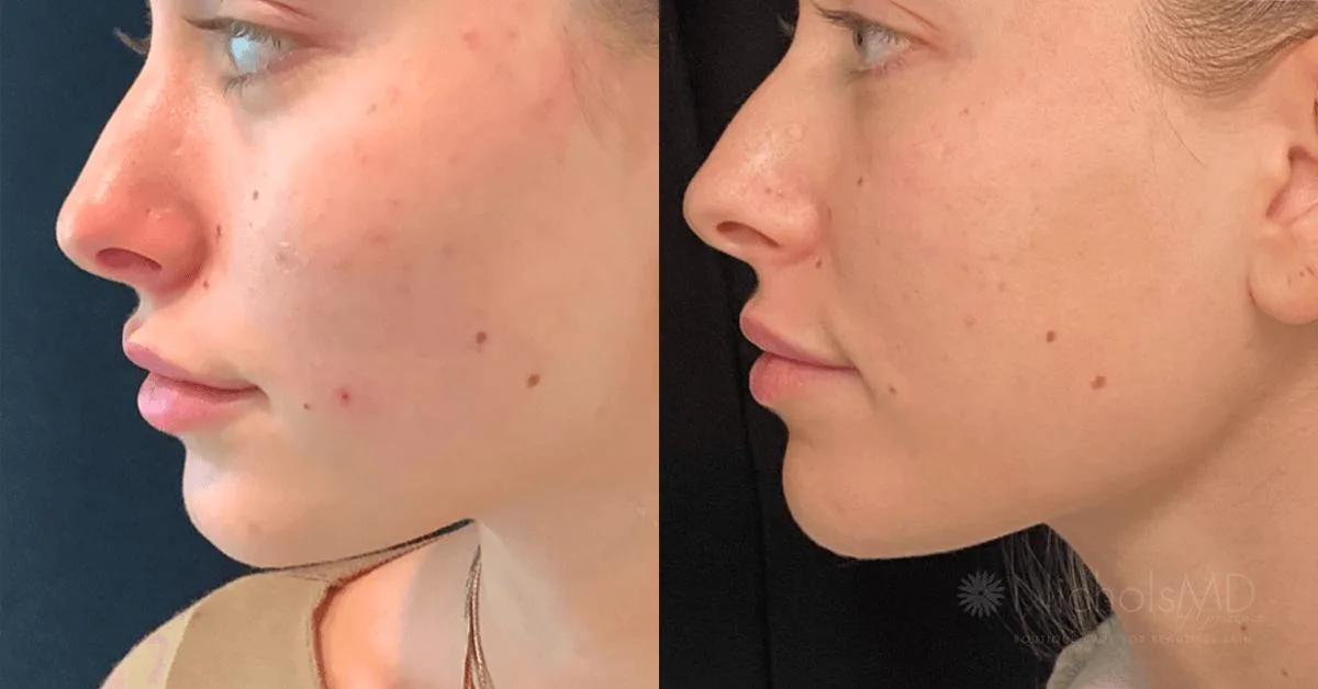 3. PRP Therapy (Platelet-Rich Plasma) image 1