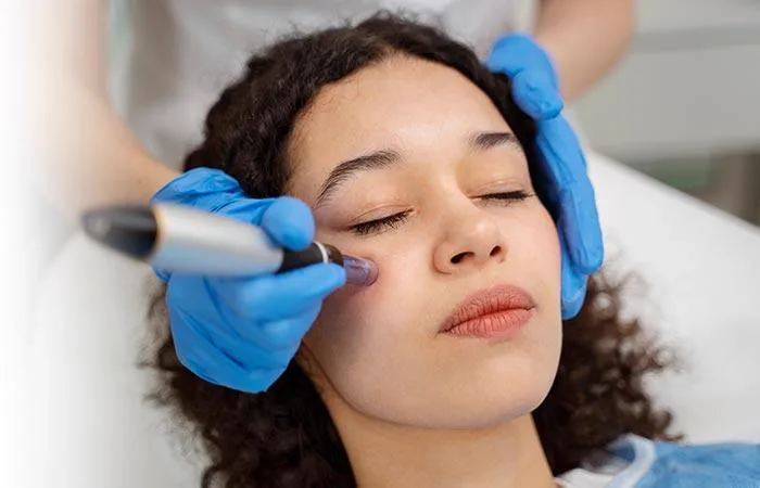 3. PRP Therapy (Platelet-Rich Plasma) image 2