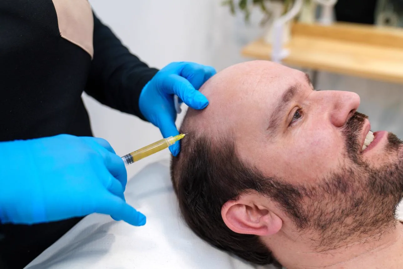 6. PRP Therapy for Hair (Adjunct Treatment) image 3