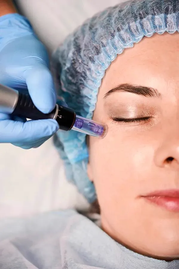 6. Peptide Therapy for Skin Tightening image 2