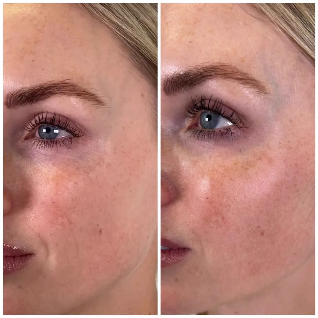 2. Skin Boosters for Glow & Texture image 3