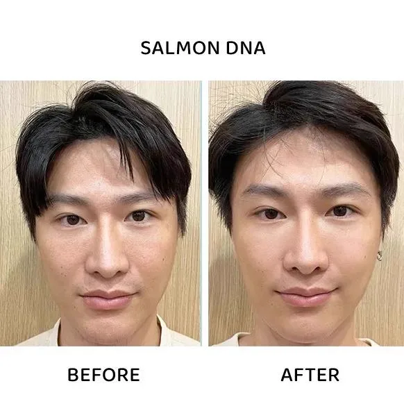 1. Skin Rejuvenation & Glow Boost image 2