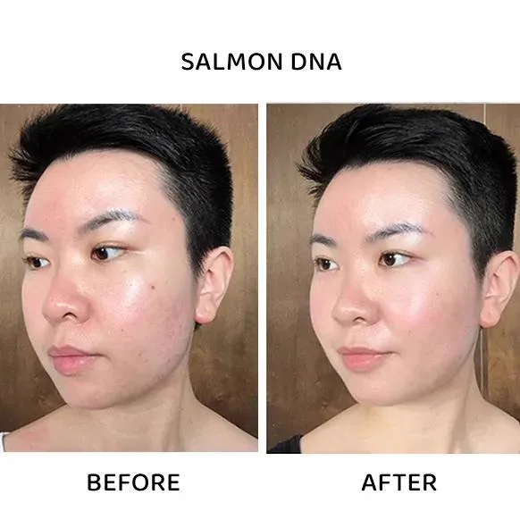 3. Treatment for Pigmentation & Uneven Skin Tone image 1